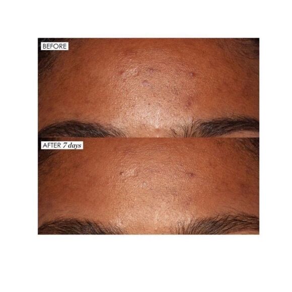 $5 🌙‎ Sunday Riley Good Genes Lactic Acid Treatment - Picture 6 of 9